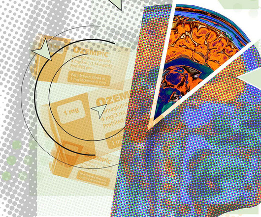 article thumbnail