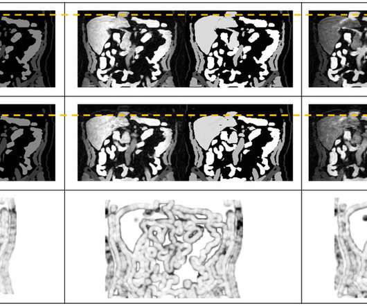 article thumbnail